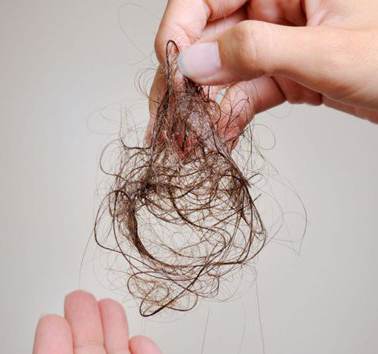 Tóc bị rụng rất nhiều sau khi gội đầu